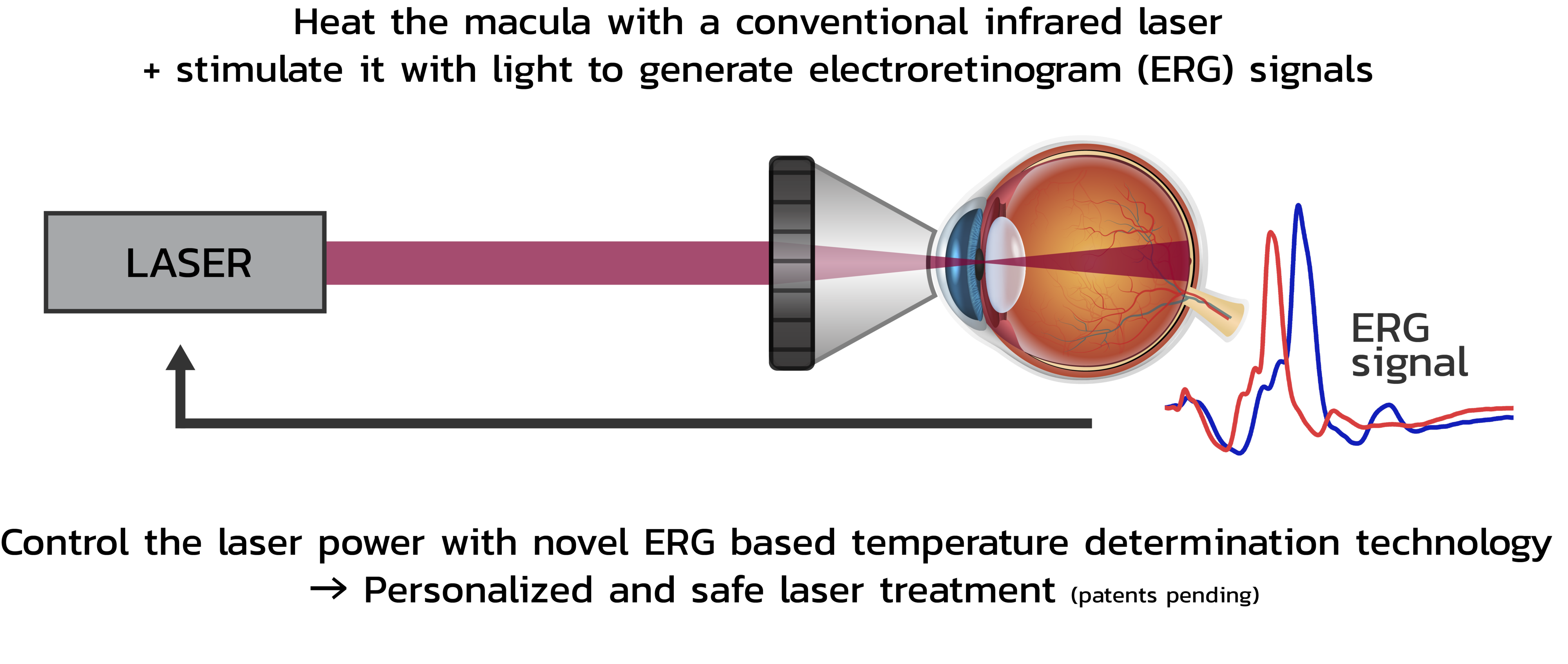 Graphics of non-damaging laser treatments.